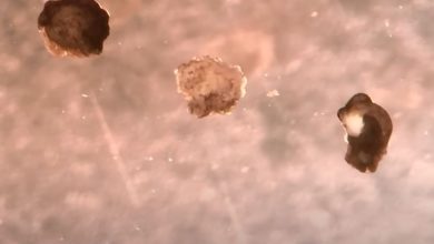 Yaşayan Robotlar “Xenobots” 18 xenobots